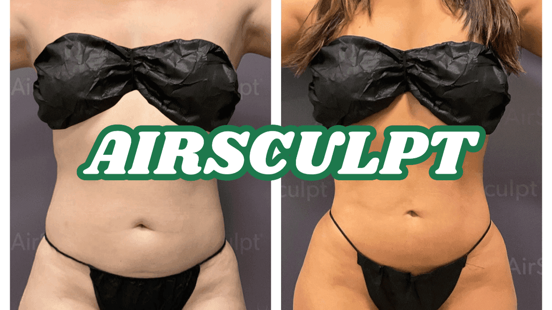 My Airsculpt Experience ✨