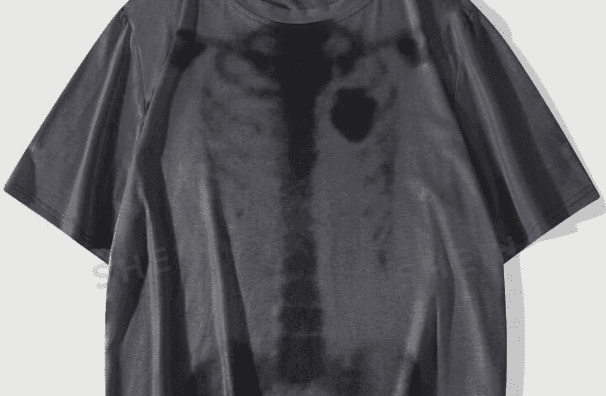 X-ray