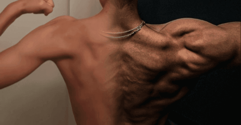 6 Week Lean Aesthetics Program 