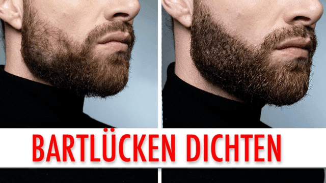 Bartlücken dichten