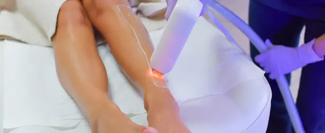 Laser Hair Removal Services: Smooth Skin Awaits You
