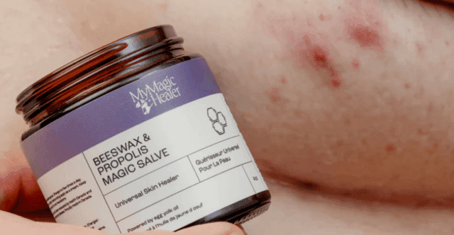 MyMagicHealer Salves | discount code FARAH12