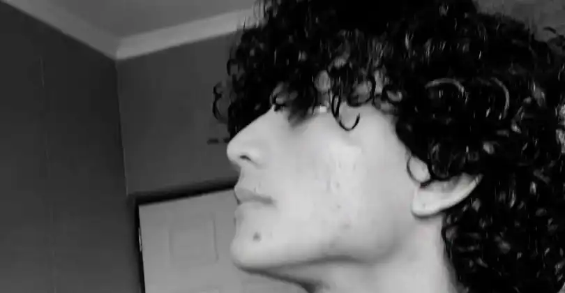 Twitch